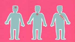 Carence en fer : causes, symptômes, diagnostic et traitement